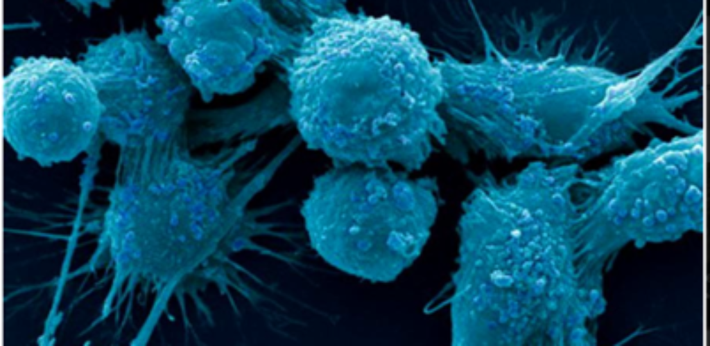 Ученые научились «сжигать» раковые клетки при помощи магнитных наночастиц