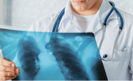 В Казахстане снижена заболеваемость туберкулезом