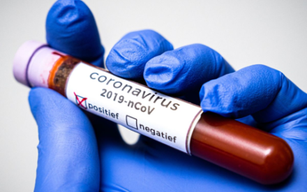 Немецкие ученые сообщили о возможном прорыве в борьбе с коронавирусом