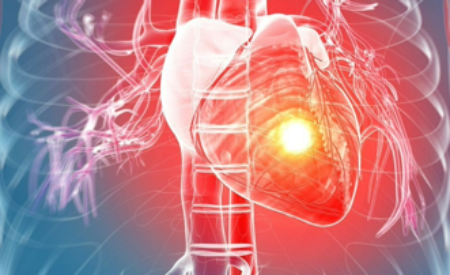Ученые выяснили, как восстановить сердце после инфаркта
