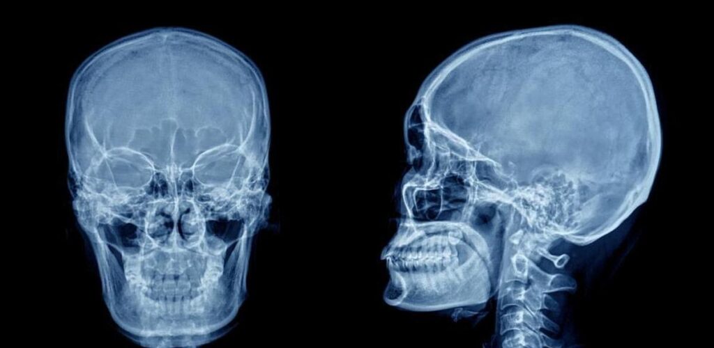 Золотое сечение черепа человека: случайность или эволюция