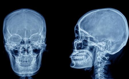 Золотое сечение черепа человека: случайность или эволюция