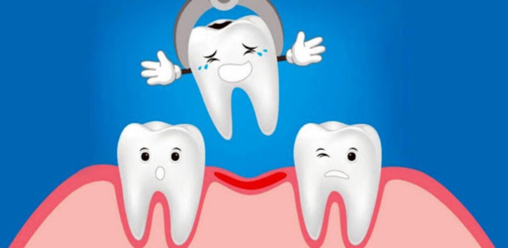 Чем грозит отсутствие зуба, и почему «мосты» и протезы не спасают от деформации челюсти