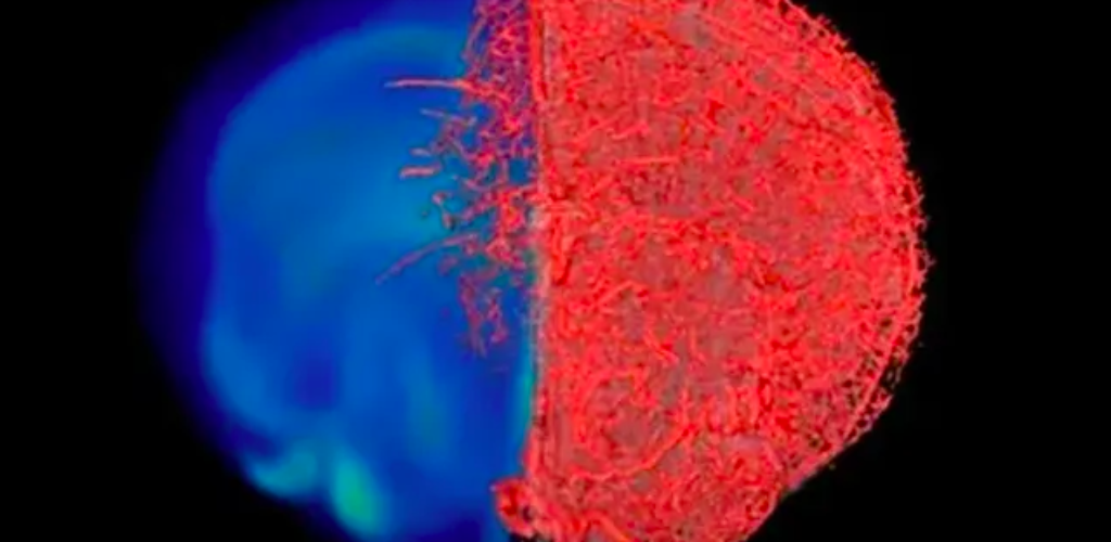 Уникальная технология визуализации: посмотрите, как выглядят сосуды нашего тела
