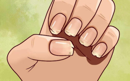 Почему люди грызут ногти — детская привычка, от которой сложно избавиться