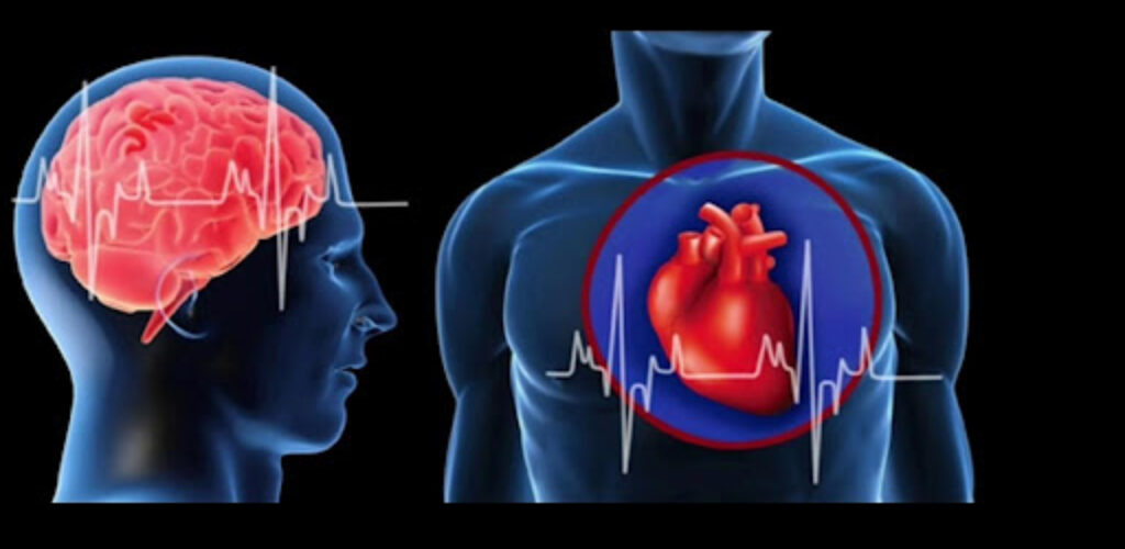 В чем разница между инсультом и сердечным приступом