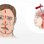 фото: https://vyborok.com/