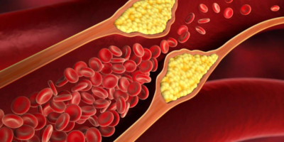 фото: https://expertpososudam.ru/ 