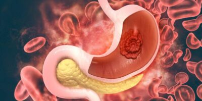 фото: https://medboli.ru/ 