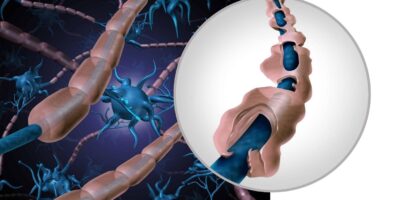 фото: https://suomenseniorihoiva.fi/ 