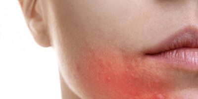 фото: https://polyclin.ru/ 