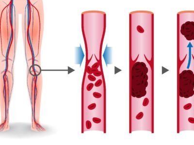 фото: https://nypost.com/ 