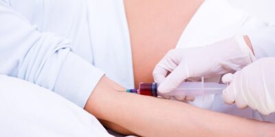 фото: https://омикрон76.рф/